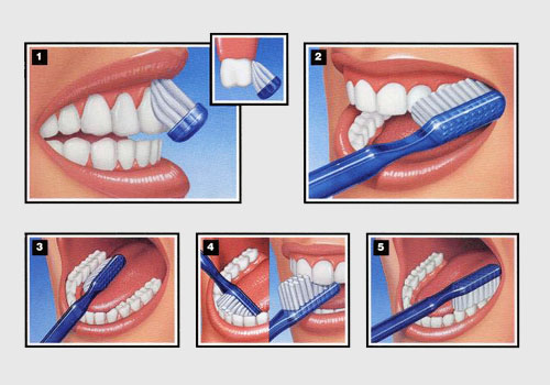 How to properly brush your teeth?