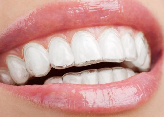 How can I straighten my teeth?