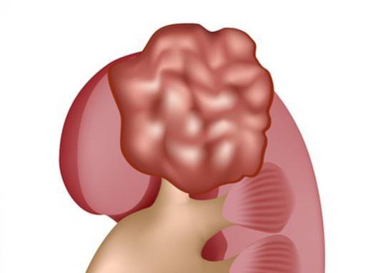 What is the parenchyma?