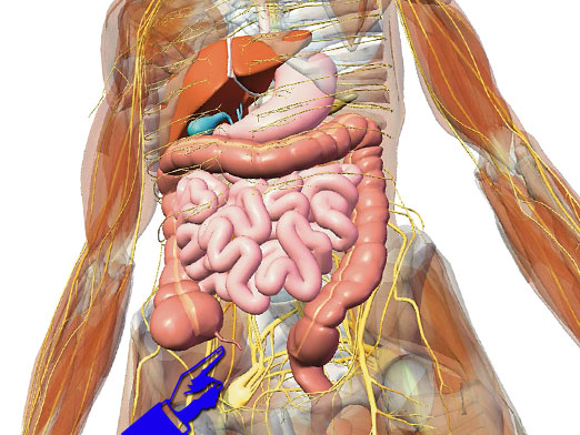 Where is appendicitis located?