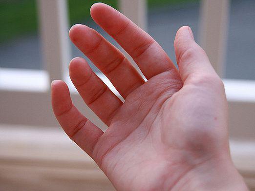 The hand hurts: what to do?